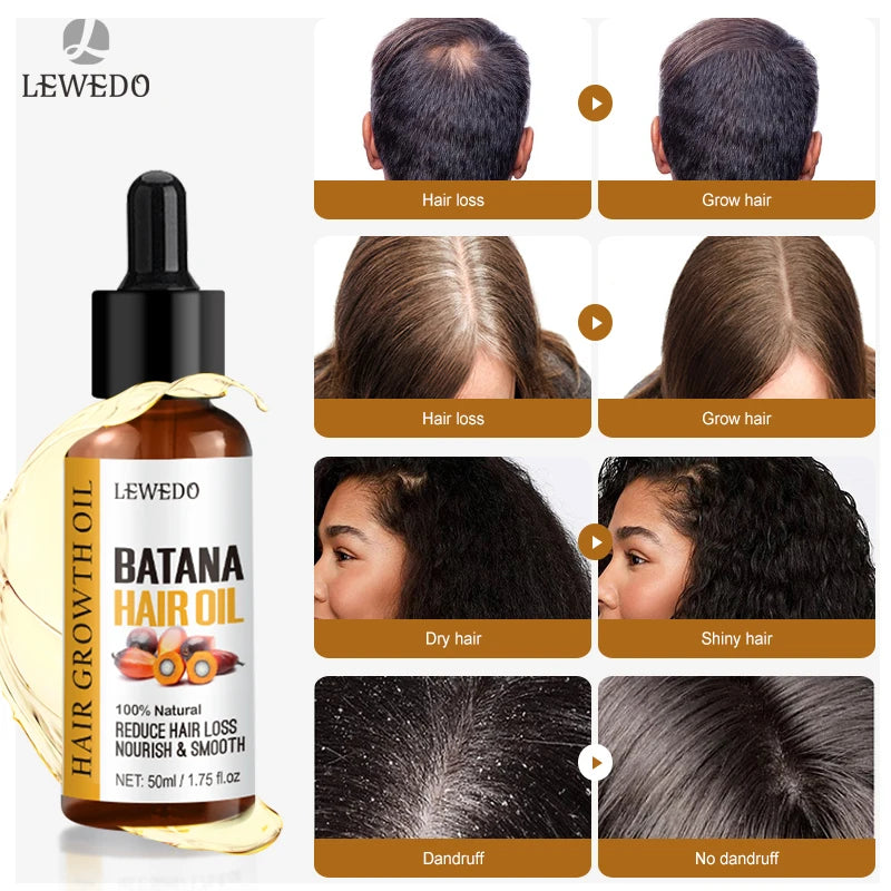 Sérum d'huile de Batana pour la croissance des cheveux, huile essentielle pour cheveux à croissance rapide, soins capillaires de beauté, Essence Anti-perte de cheveux, réparation naturelle des cheveux endommagés