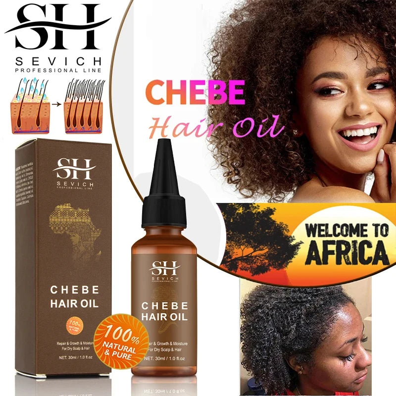 Sevich afrique huile de croissance des cheveux 30ml Traction alopecia Chebe poudre huile d'essence Anti perte de cheveux traitement produit épaissir soins des cheveux