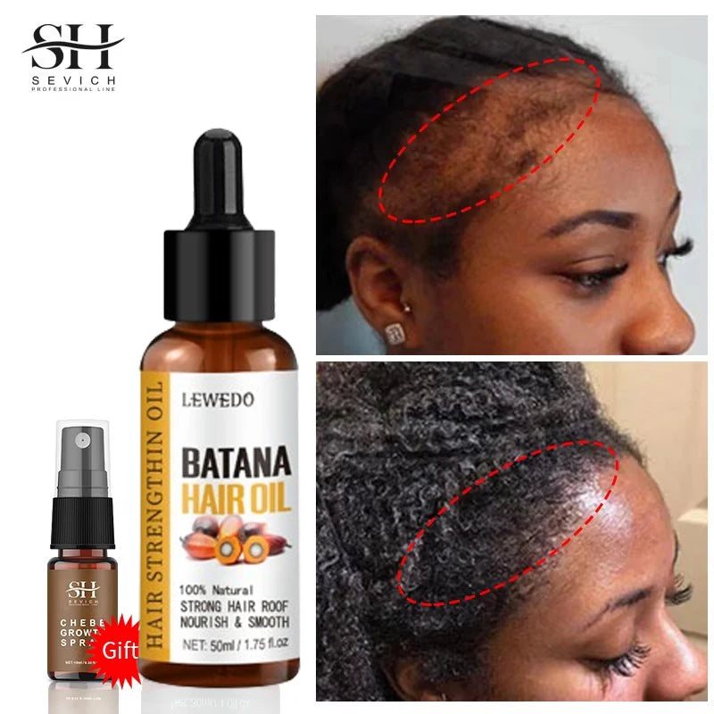 Sérum d'huile de Batana pour la croissance des cheveux, huile essentielle pour cheveux à croissance rapide, soins capillaires de beauté, Essence Anti-perte de cheveux, réparation naturelle des cheveux endommagés