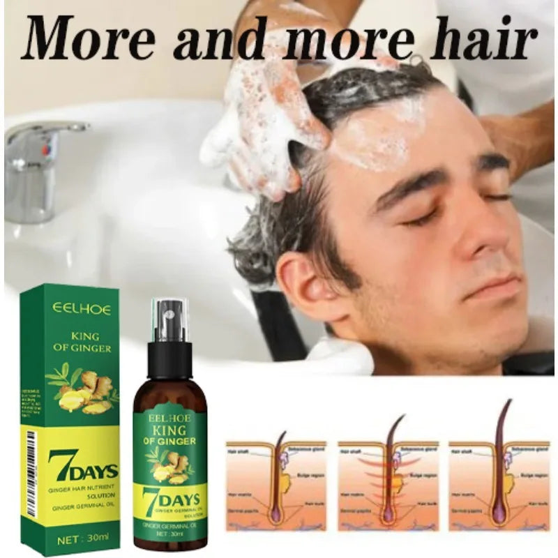 Sérum de croissance rapide des cheveux au gingembre, anti-chute, traitement de la calvitie, huile de soin capillaire, réparation du cuir chevelu endommagé, traitement pour femmes et hommes