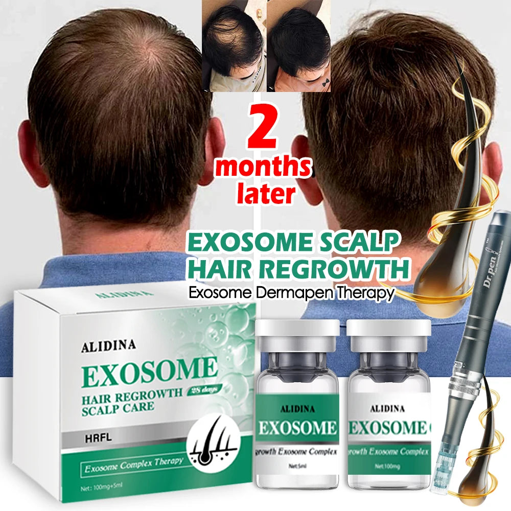 GD Le sérum essentiel pour la croissance des cheveux à l'exosomes Bio-scalp le plus efficace en 2025. efficace pour réparer la calvitie et la repousse des cheveux