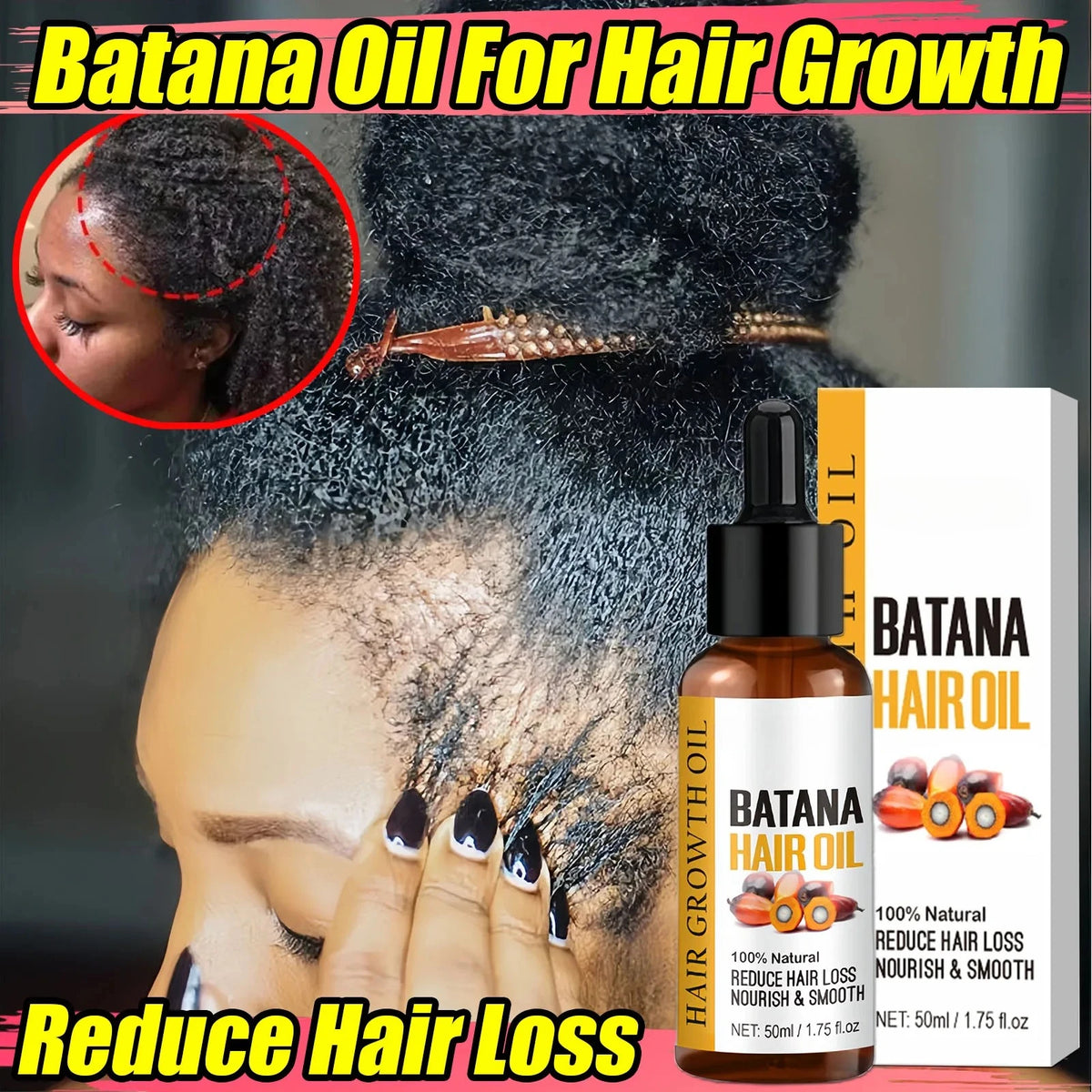 Huile de Batana pour la croissance des cheveux, produits de croissance rapide, huile essentielle de Batana, traitement contre l'alopécie, la perte de cheveux et la calvitie pour hommes et femmes