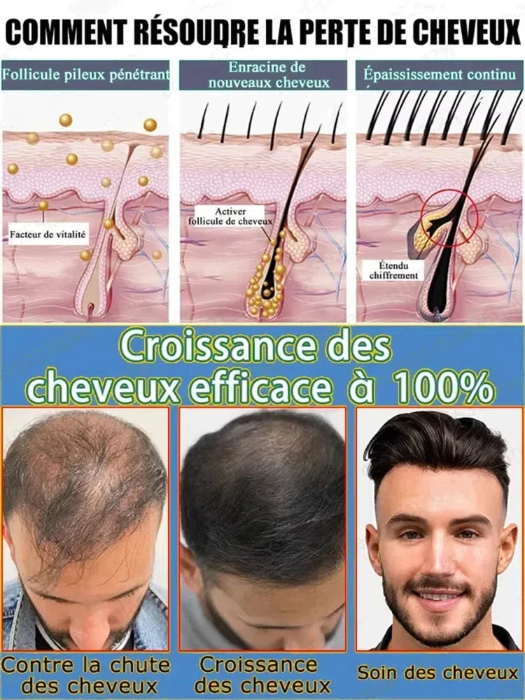 25 follicules dormantes Awaken HT pour cheveux abondants