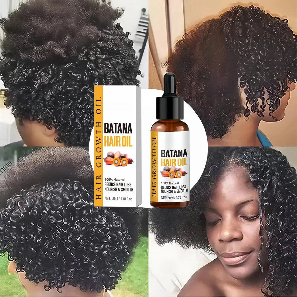 Huile de Batana pour la croissance des cheveux, produits de croissance rapide, huile essentielle de Batana, traitement contre l'alopécie, la perte de cheveux et la calvitie pour hommes et femmes