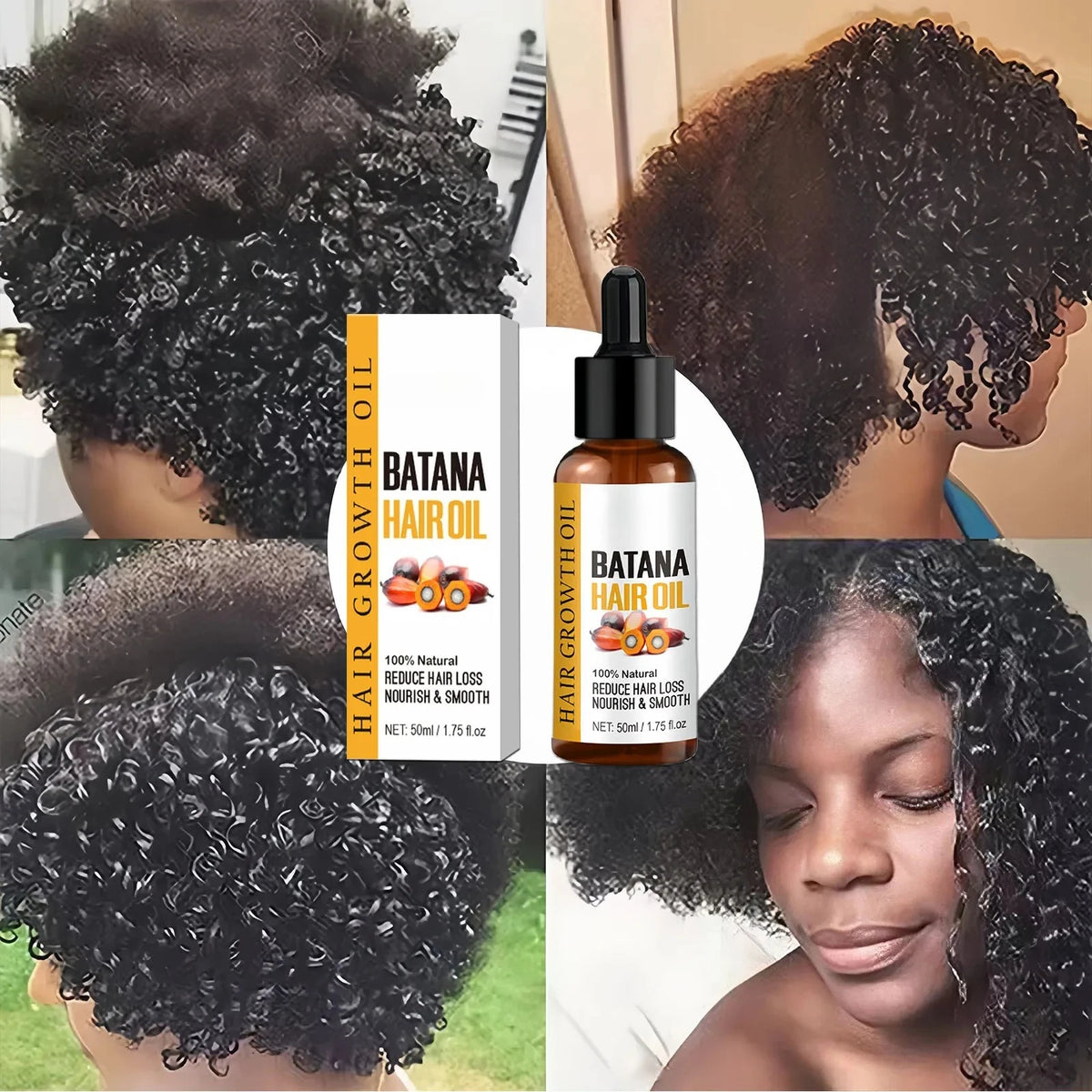 Huile de Batana pour la croissance des cheveux, produits de croissance rapide, huile essentielle de Batana, traitement contre l'alopécie, la perte de cheveux et la calvitie pour hommes et femmes