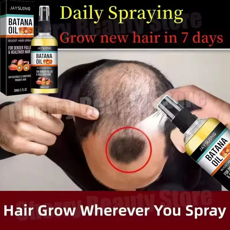 Sérum capillaire en spray à l'huile de Batana pour la croissance des cheveux, repousse rapide en 7 jours, réparation, nourrissant les racines, anti-chute, essence pour hommes et femmes, produits de soin capillaire