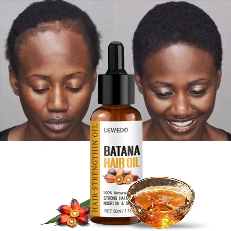 Lewedo Naturals huile de Batana croissance rapide des cheveux pour hommes femmes huile de Batana Pure nourrir les cheveux brillants soins capillaires sains Anti perte de cheveux