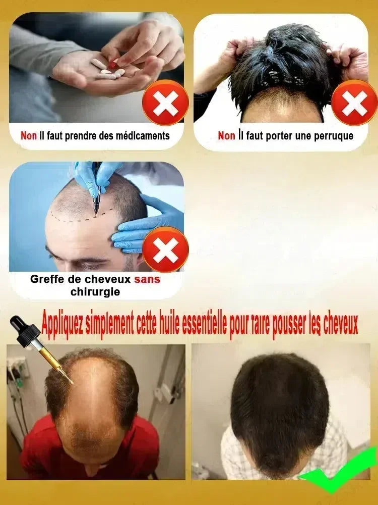 25 follicules dormantes Awaken HT pour cheveux abondants