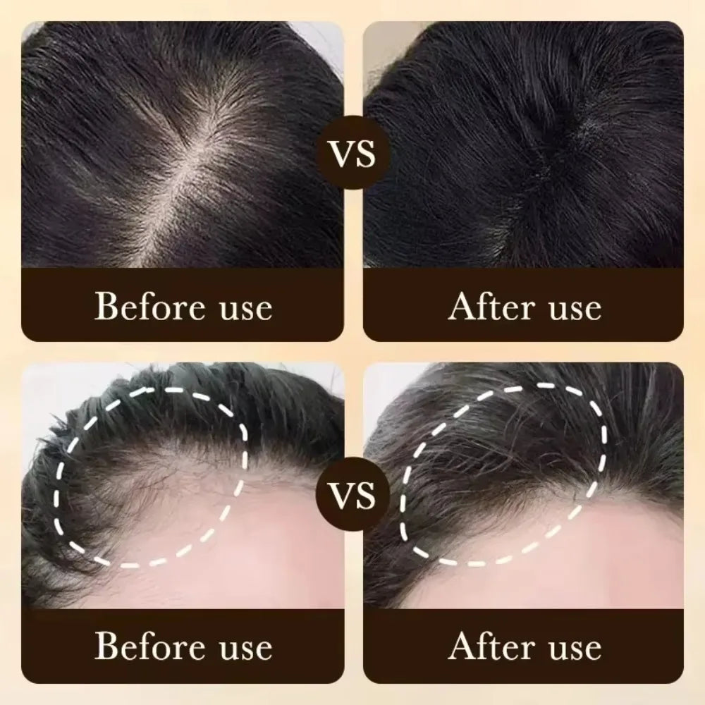Sérum de soin capillaire quotidien pour la croissance des cheveux, nourrit le cuir chevelu, léger, non gras, favorise des cheveux plus fournis et plus sains.